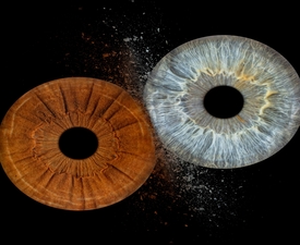 Превърнете вашите очи в уникална картина с ирисова фотография в Пловдив  - заснемане на четири ириса в рамка