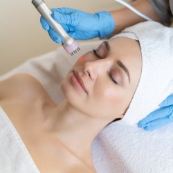 Красива и стегната кожа без бръчки с Радиочестотен лифтинг на лице в Пловдив